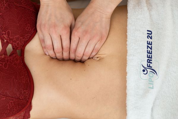 diastasis recti treatment Lutterworth