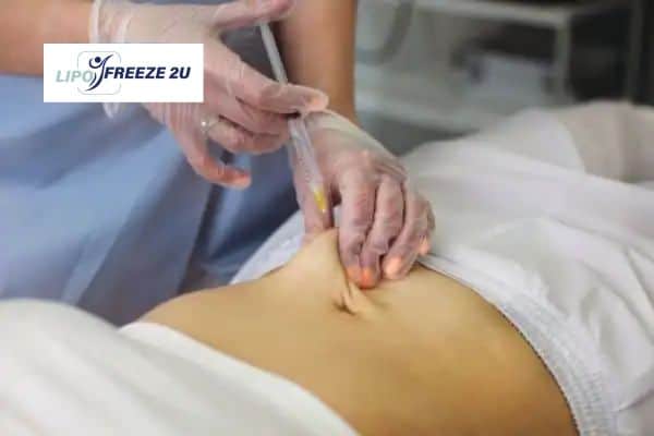 Fat Dissolving Injections Lutterworth & Weight loss medication