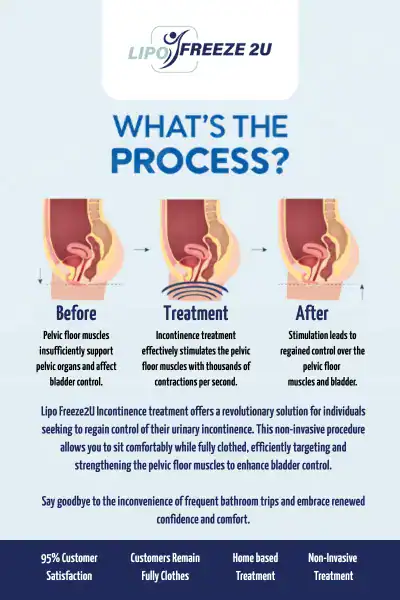 Diagram of how incontinence treatment Lutterworth works.