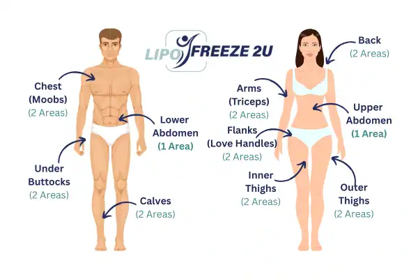 Areas you can have fat freezing treatment Lutterworth