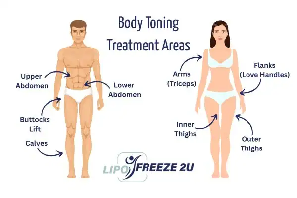 Graphic showing where you can have Body toning Treatment Lutterworth on your body
