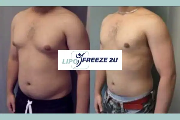 How Long Does It Take to See Results Lutterworth?