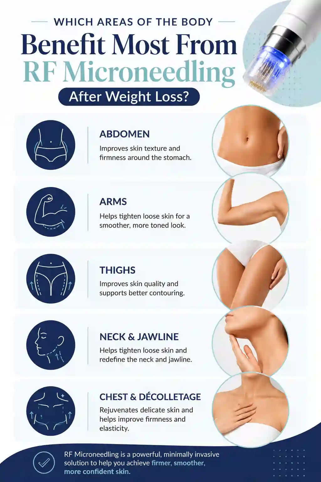 Which Areas of the Body Benefit Most From RF Microneedling After Weight Loss Lutterworth